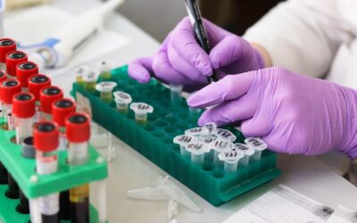 Proovide andmine Medicolm Perearstikeskuses